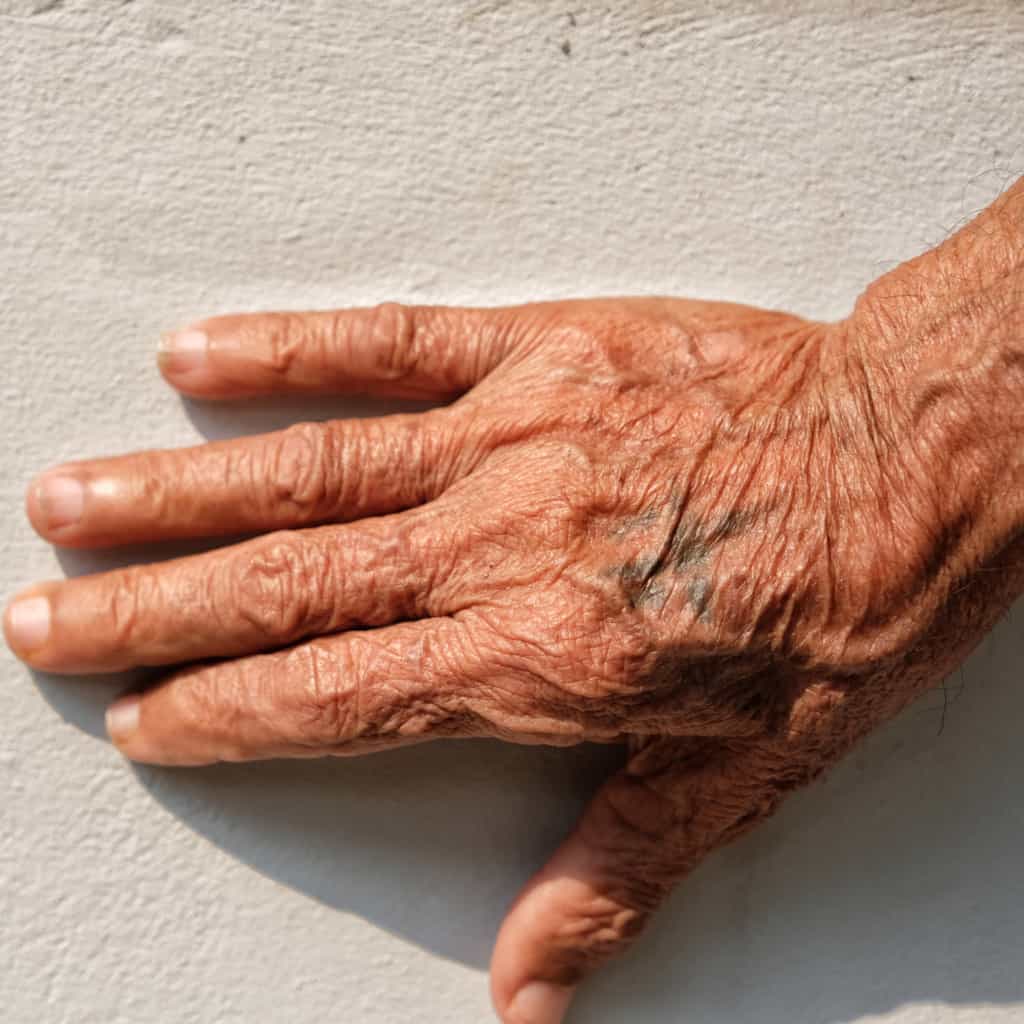 Small and Faded Hand Tattoo with visible signs of Aging | selftattoo.com