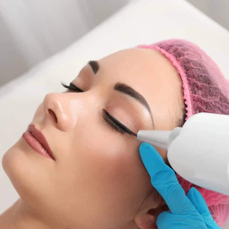 Woman laying down undergoing Cosmetic Laser Treatment around the Eye area | selftattoo.com