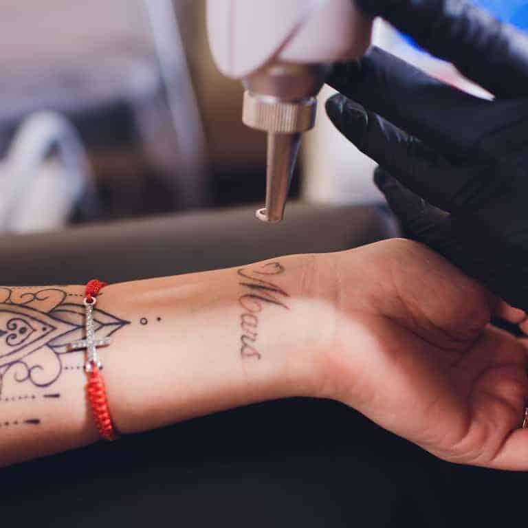 Close-up of a Person's Wrist with Visible Tattoos getting Treatment for Laser Tattoo Removal | selftattoo.com