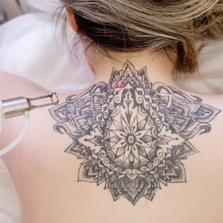 Laser Tattoo Removal Device with a Visible Red Laser Dot targeting an Upper Back Tattoo | selftattoo.com