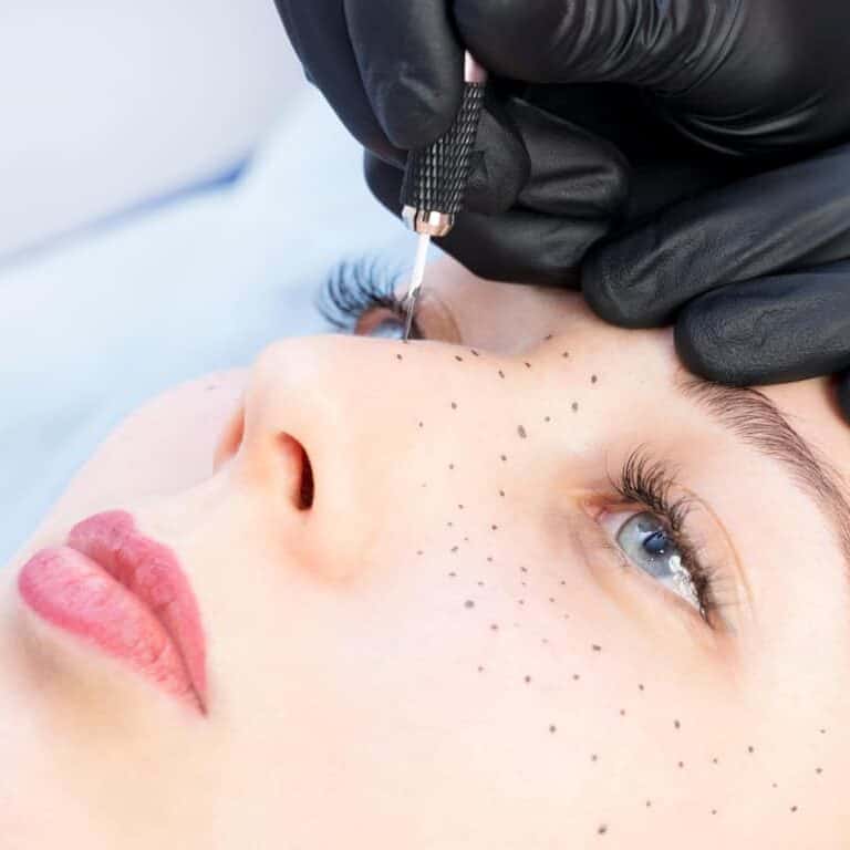 Cosmetic Practitioner applying Small Dots of Pigment under the Eyes creating Freckles | selftattoo.com